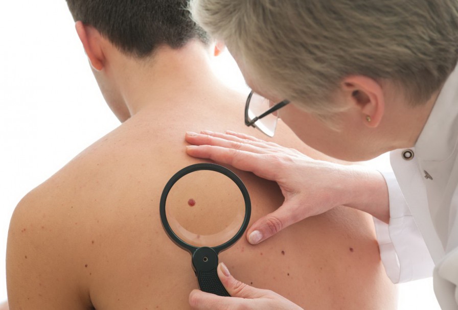 diagnostico de herpes en la espalda