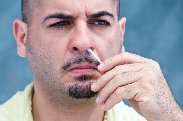remedios caseros para herpes en la nariz