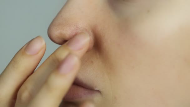 sintomas de herpes en la nariz