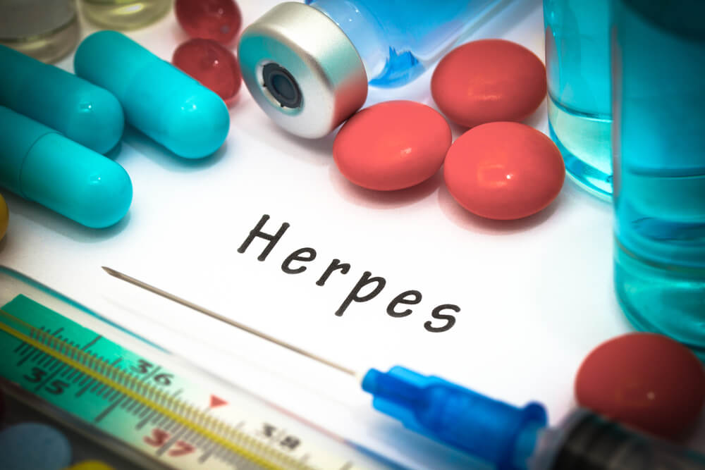 tipos de tratamiento para el herpes