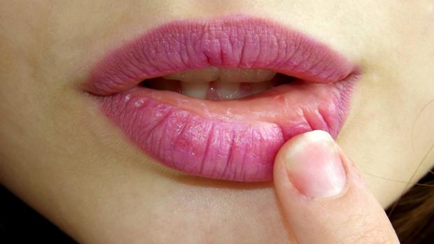 contagio de herpes genital por tocar herpes labial